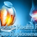 Acibadem Health Point Knee Replacement